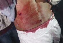 बारात में गाना बजाने को लेकर चाकूबाजी, युवक गंभीर रूप से घायल।